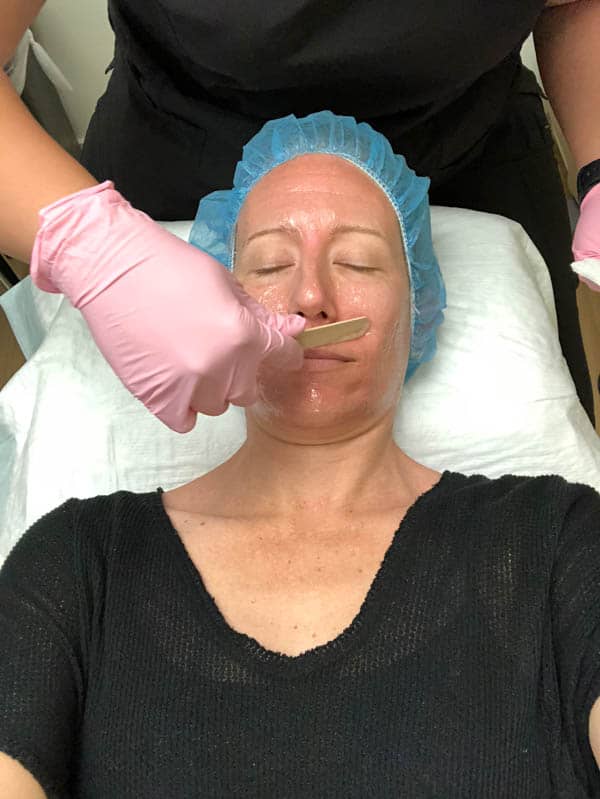 A gloved woman using a popsicle stick to rub on a gel before a laser facial treatment.