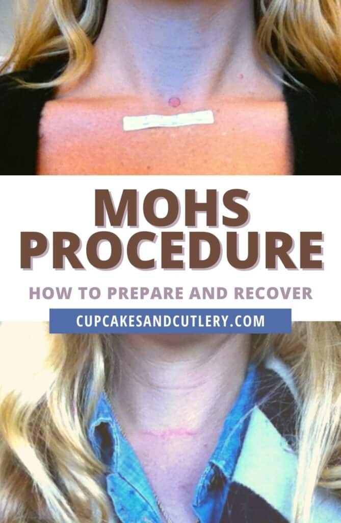 Collage of images of before and after the mohs procedure.